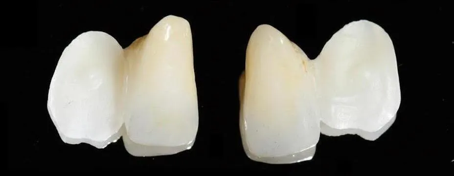 photo d'un autre bridge