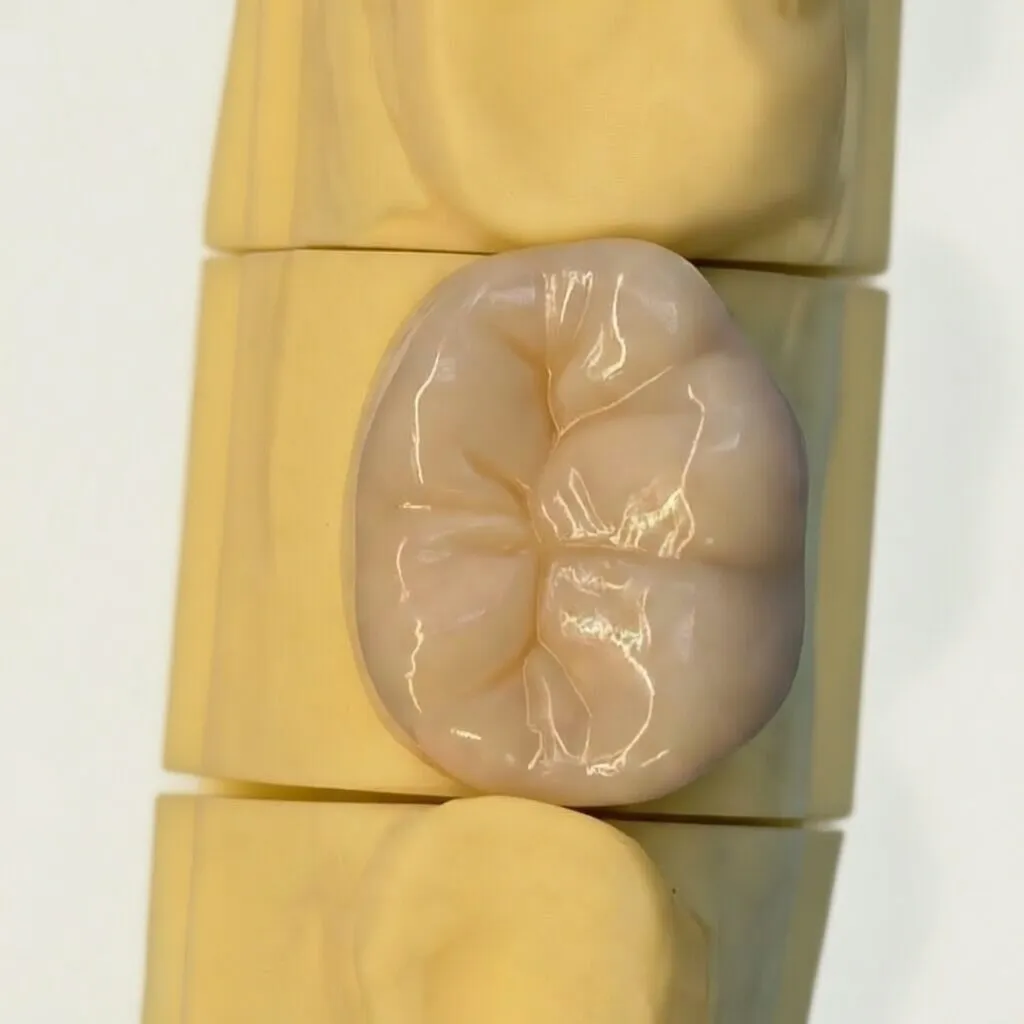 couronne vue du dessus